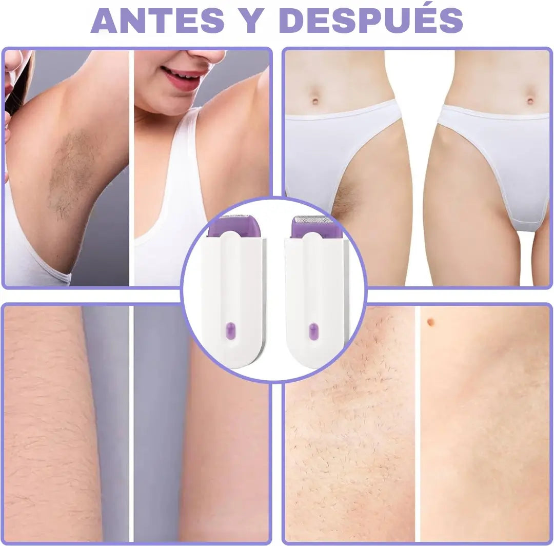 💆♀️ LáserCare™ – Cuida tu Piel mientras Elimina el Vello ✅