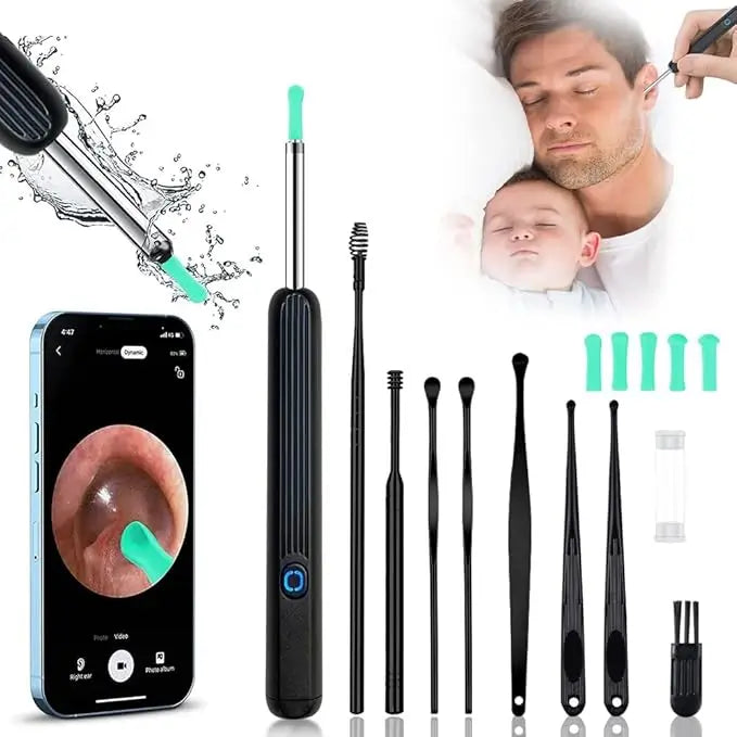 🧼 Kit Limpieza Oídos™ – Limpieza segura con cámara HD