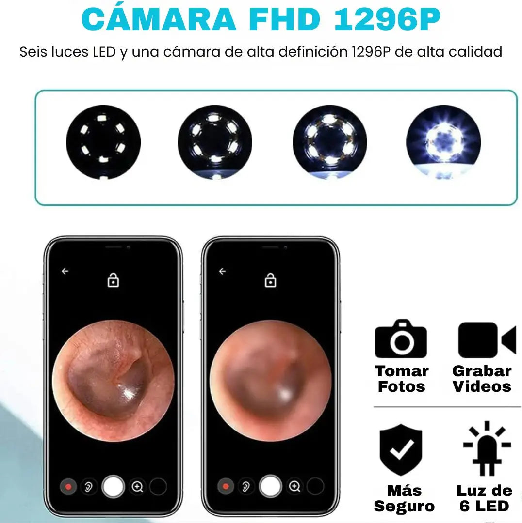 🧼 Kit Limpieza Oídos™ – Limpieza segura con cámara HD